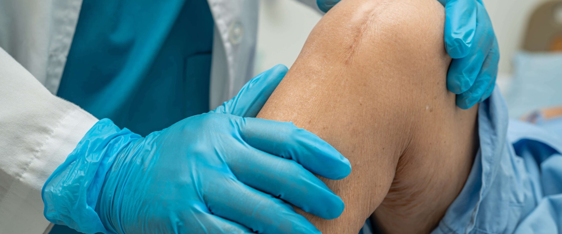 Expert Guide on How Long It Takes for Stitches to Heal After Surgery With Proven Tips for Safe Recovery