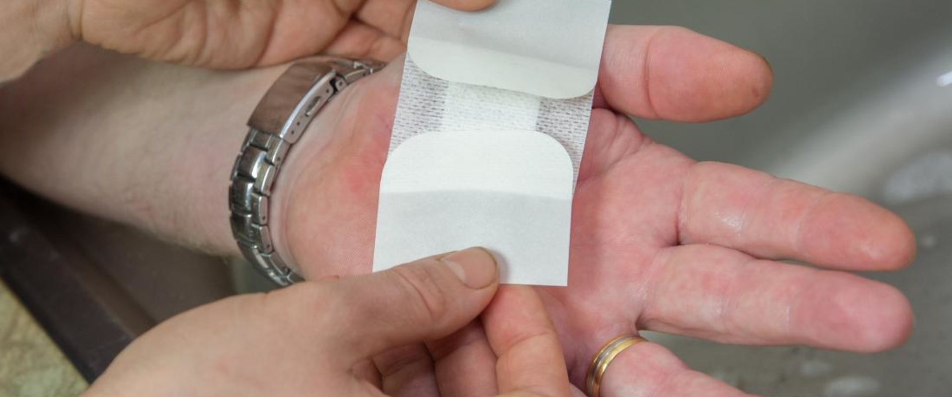 Wound Exudate Types and Colors You Should Know