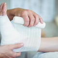 Complete Guide on How to Treat Wounds That Won’t Heal Expert Advice for Recovery