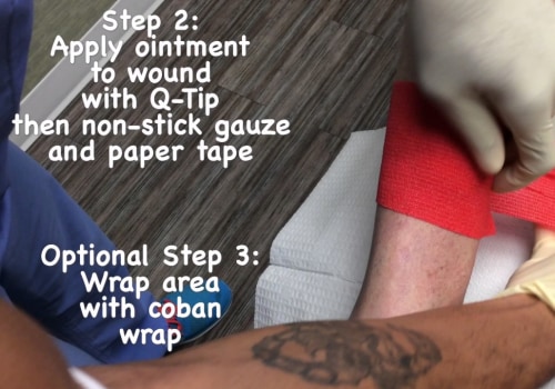 Mupirocin Ointment on Open Wounds: Is It Safe for Use With Wound VAC Therapy?