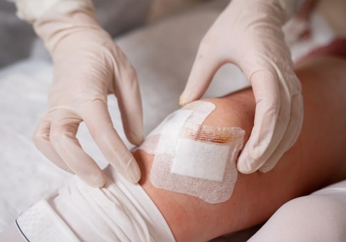 Managing Slow Healing Wounds Effectively With the Power of Wound VAC