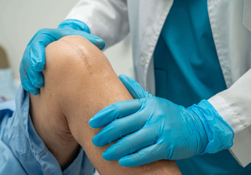 Expert Guide on How Long It Takes for Stitches to Heal After Surgery With Proven Tips for Safe Recovery